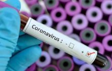 نکات کلیدی برای پیشگیری‌های از بیماری‌های کرونا و آنفلوآنزا+تصاویر